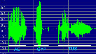 Sound wave graph of Aegyptus